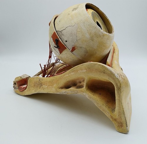 Sehr seltenes anatomisches