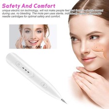 Warzen Entferner Pen USB Laser