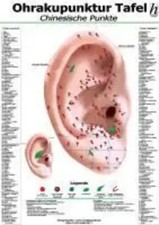 Ohrakupunktur-Tafel -