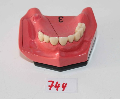 Dent schaumodell 3 - dent,