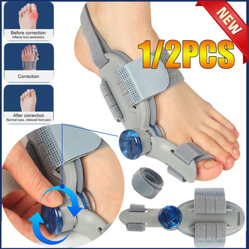 Hallux valgus korrektur - 2~hallux,
