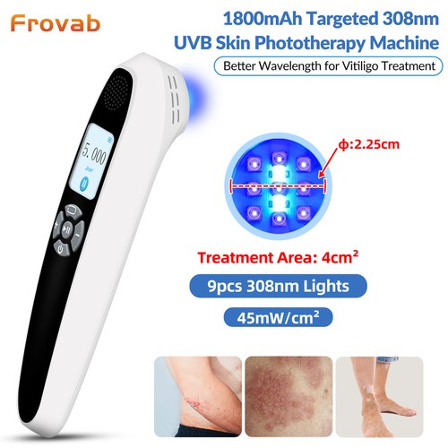 308nm ultraviolet uvb lamp - ultraviolet,
