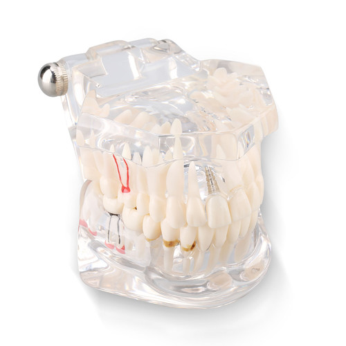 Zahnmodell für dentalschulen - zahnmodell,