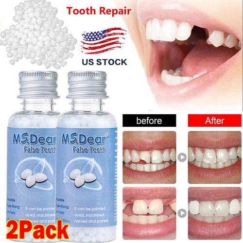 Tooth repair kit - repair,