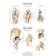 anatomische Lehrtafel Das Knie / Die Hüfte Anatomie Poster, Größenwahl