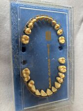 Zahnspange  Ok Und Uk