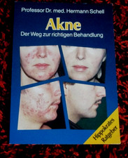 Hermann Schnell, Akne, der Weg
