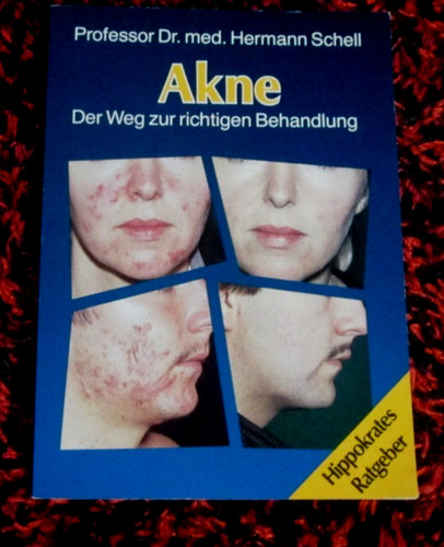 Hermann schnell akne der - akne,, weg