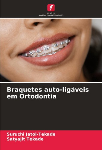 Braquetes auto ligáveis - braquetes, auto-ligáveis