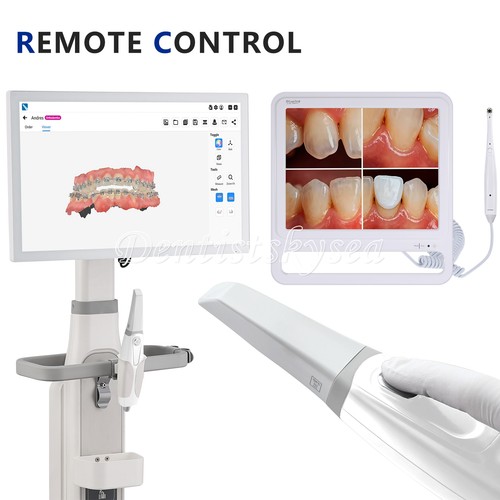 Dental intraoralscanner - dental,