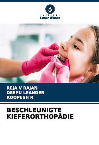 BESCHLEUNIGTE