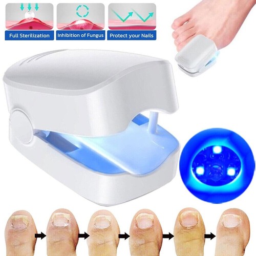 Laser nagelpilz fungal - fungal, nail