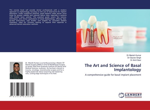 The art and - the, of