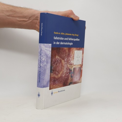 Fallstricke und fehlerquellen - fallstricke,