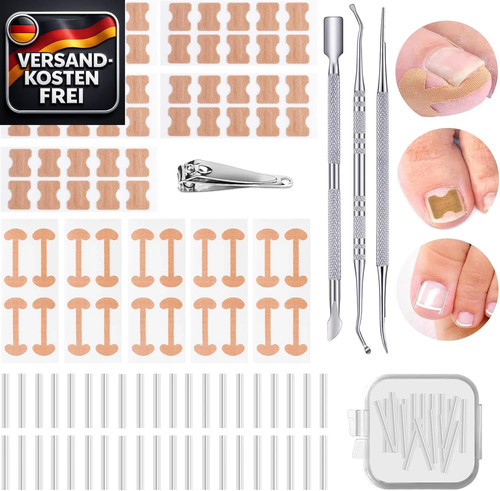 Eingewachsene zehennagel set - eingewachsene,