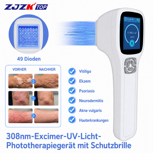308nm excimer phototherapy - excimer,