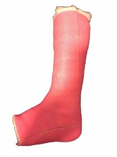 Gipsfuß/bein Cast SLC