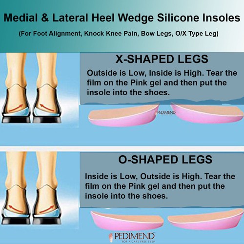 Pedimend supination - pedimend™, &