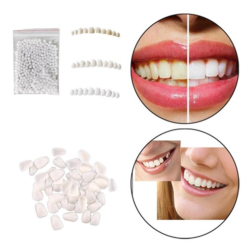 Top bottom teeth veneers - top,