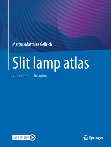 Slit lamp atlas - , |