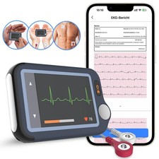 2025 Neu EKG-Gerät Bluetooth Herzmonitor 30s/60s/5min Aufzeichnung + KI-Analyse