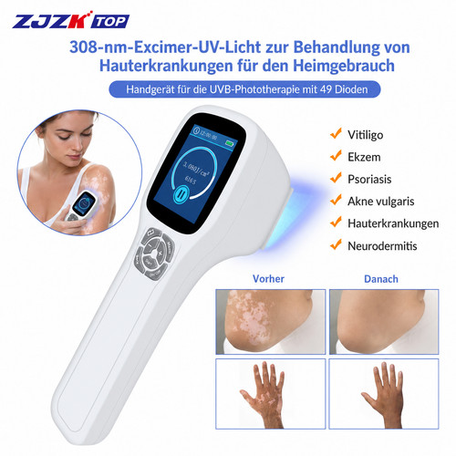 308nm uvb phototherapie lampe - uvb,