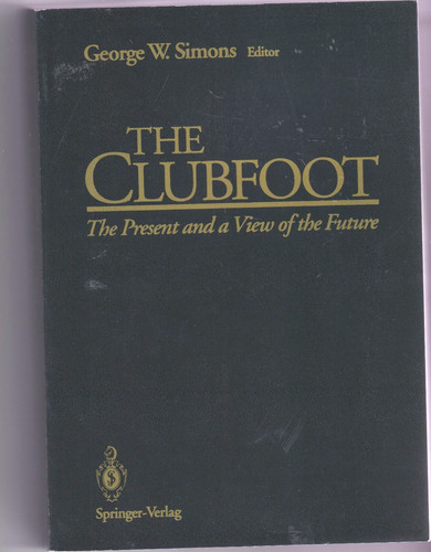 The clubfoot present and - clubfoot:,