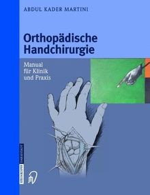 Orthopädische handchirurgie - orthopädische,
