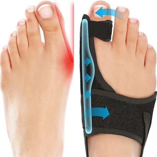Hallux valgus korrektur - valgus,