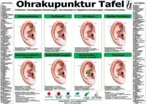 Ohrakupunktur tafel - ohrakupunktur,