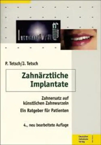 Zahnärztliche implantate - zahnärztliche,