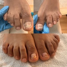 Mobile Fachfusspflegerin