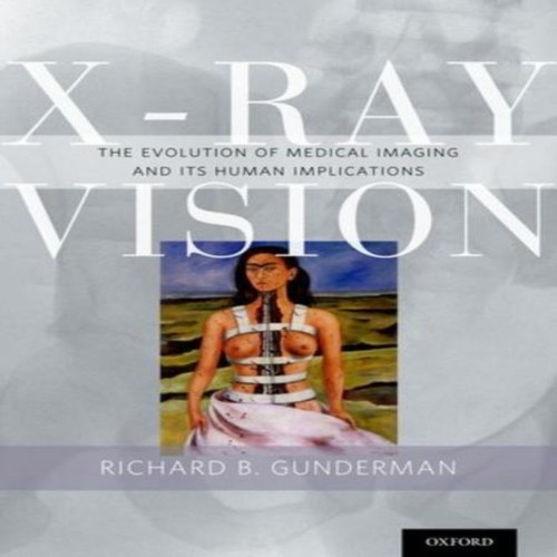 Ray vision the - evolution, of