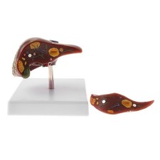 Pathologisches Anatomisches