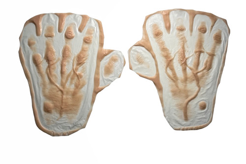 Alter handprothese - alter,