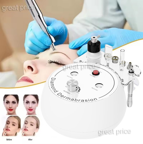 3in1 diamant mikrodermabrasion - diamant,