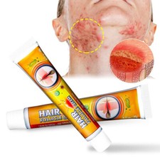 20g/40g Haarfollikel