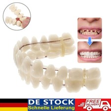 Snap-On Veneers Kosmetische