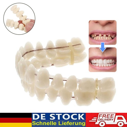 Snap veneers kosmetische - snap-on,