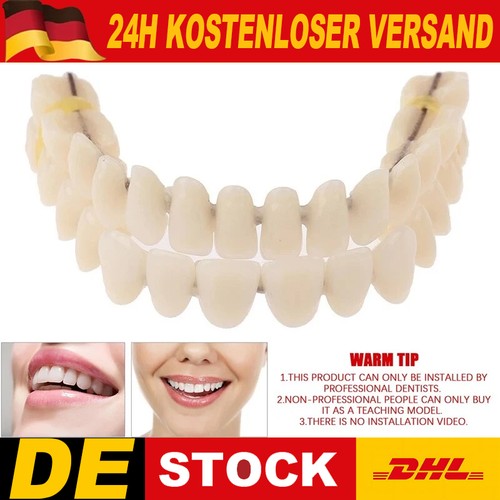 Snap veneers kosmetische - on,