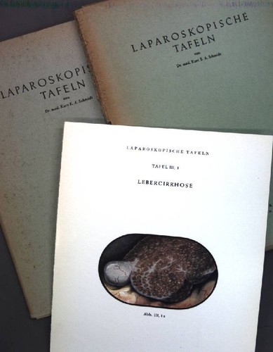 Laparoskopische tafeln - laparoskopische,