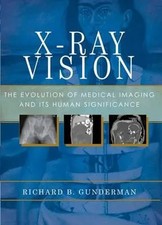 X-Ray Vision The Evolution of