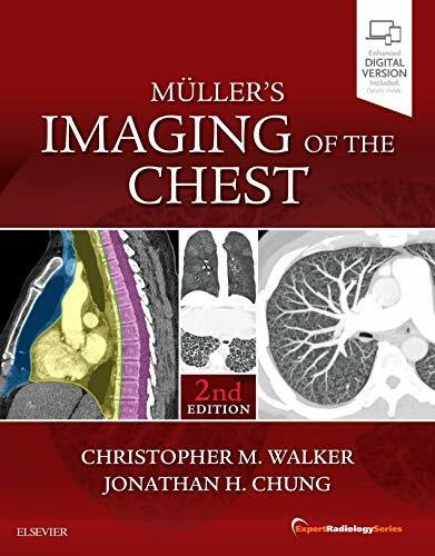 Muller imaging the chest - imaging,