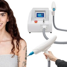 ND Yag Laser Tattooentfernung