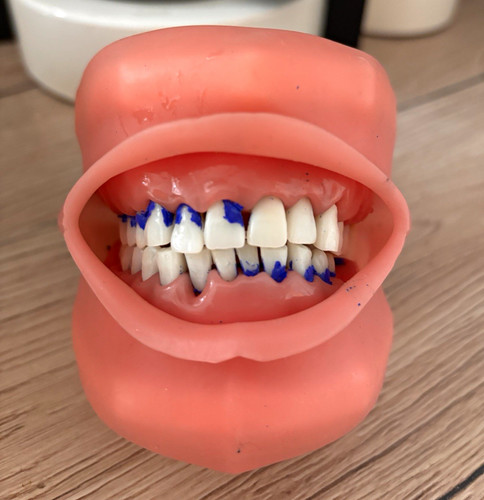 Nissin dental model - nissin,