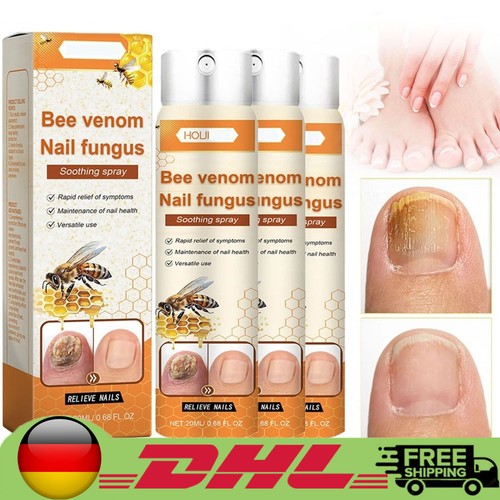 Bee venom nail fungus - venom,