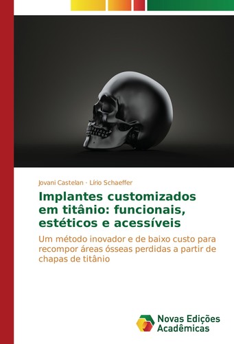 Implantes customizados - , em