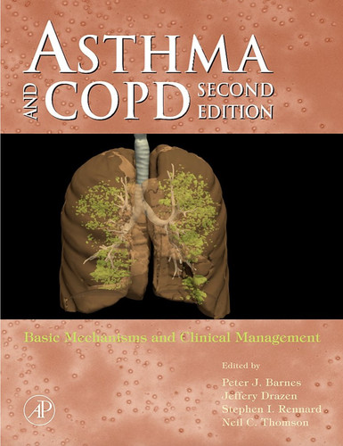 Asthma and copd - asthma, copd: