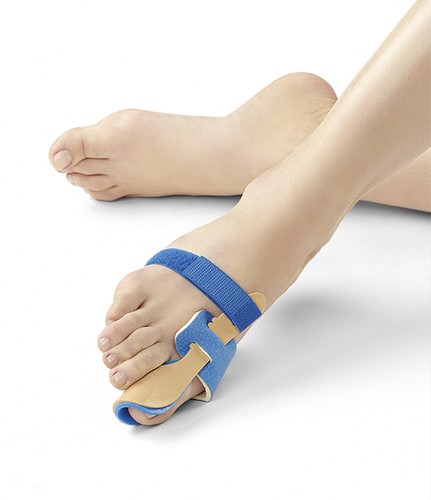 Dynamics hallux valgus - dynamics,