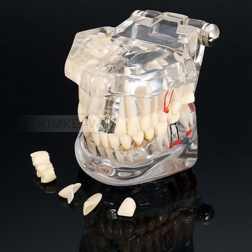 Dental zahnarzt zahntechnik - dental,